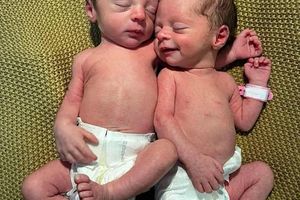 Noworodki wspólnie leżące.