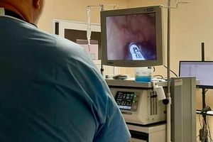 Kamera medyczna w użyciu.