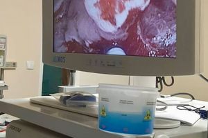 Obraz z monitora medycznego.