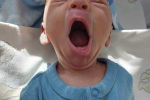 Małe dziecko ziewające.