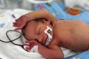 Noworodek w inkubatorze.